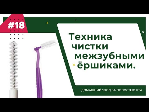 Видео: Техника чистки межзубными ёршиками. Урок №18 - ДОМАШНИЙ УХОД ЗА ПОЛОСТЬЮ РТА.