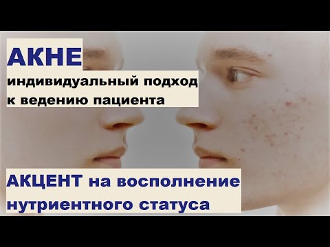 Видео: Акне: индивидуальный подход к ведению пациента. Акцент на восполнение нутриентного статуса