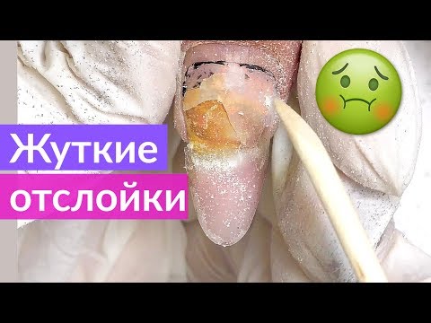 Видео: Коррекция Наращенных ногтей | Ужасные Отслойки