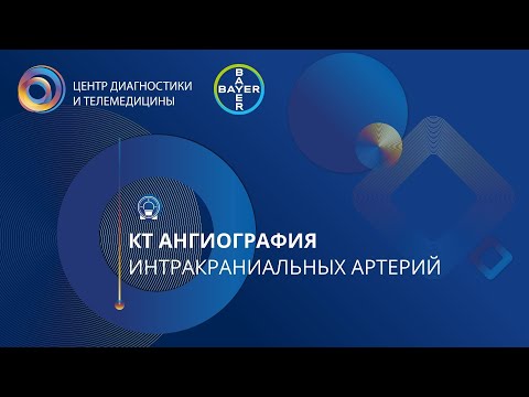 Видео: КТ ангиография интракраниальных артерий