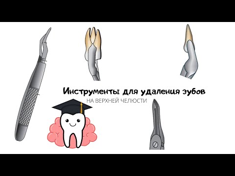 Видео: Инструменты (щипцы) для удаления зубов на верхней челюсти. Признаки щипцов.