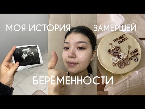 Видео: моя история замершей беременности: причины, боль и принятие