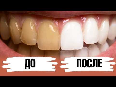 Видео: Как отбелить зубы дома? 2 ингредиента и зубная паста готова!🔥
