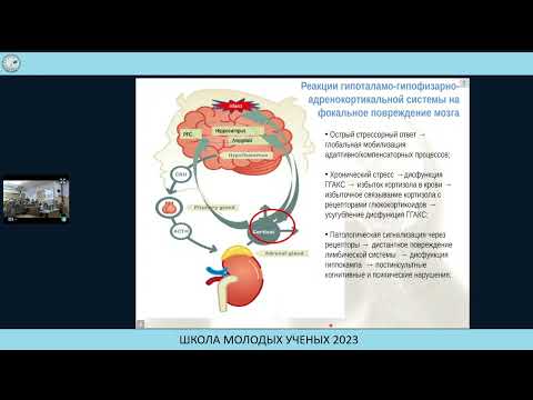 Видео: Глюкокортикоиды и постинсультные когнитивные расстройства - Гуляева Наталия Валерьевна