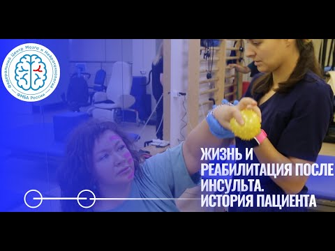 Видео: Жизнь и реабилитация после инсульта. История пациента