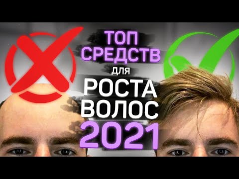 Видео: Обзор современных средств для роста волос от врача дерматолога