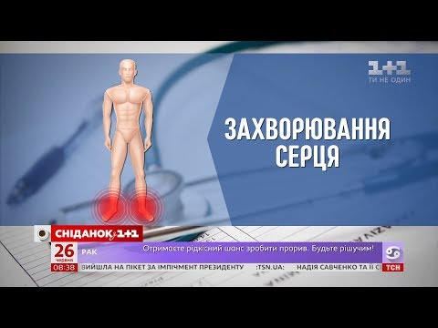 Видео: Почему отекают ноги и руки и когда стоит обратиться к врачу