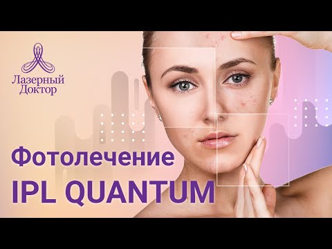 Видео: IPL Фотолечение Quantum (удаление пигментации и сосудов)