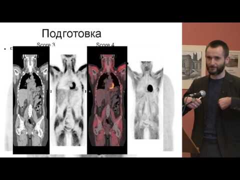 Видео: Cмолярчук М. Я. - Роль ПЭТ/КТ в диагностике и оценке эффективности терапии лимфом.