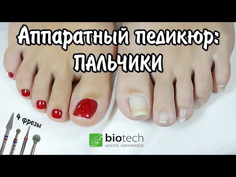 Видео: Аппаратный педикюр: Пальчики. Часть 2