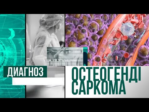 Видео: Сүйек қатерлі ісігі немесе остеогендік саркома | Диагноз