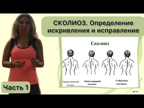Видео: Сколиоз. Тесты и упражнения с резиновой лентой .Часть 1(стоя)
