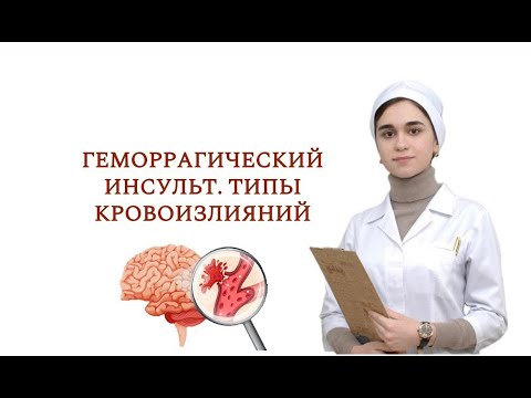 Видео: Геморрагический инсульт. Этиопатогенез. Классификация. Клиника. Диагностика. Лечение.