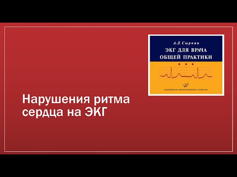 Видео: ЭКГ 3. Аритмии