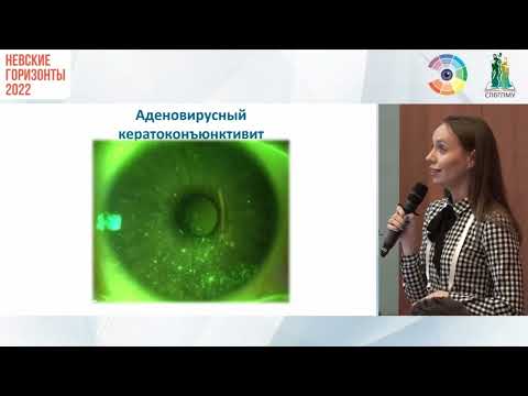 Видео: Эпителиопатии при использовании ортолинз. Дифференциальная диагностика. Тактика.