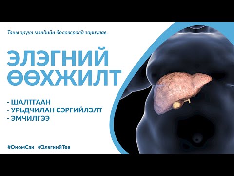 Видео: Элэгний өөхжилт гэж юу вэ?