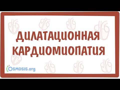 Видео: Дилатационная кардиомиопатия — причины, симптомы, патогенез, диагностика, лечение