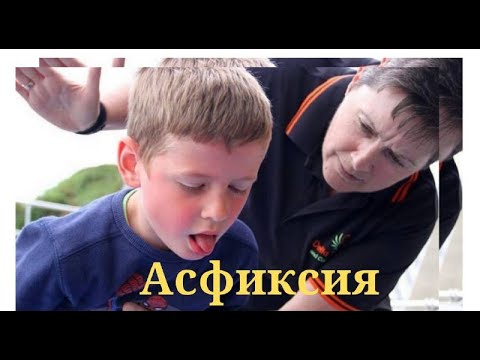 Видео: Асфиксия кезіндегі алғашқы көмек. Тұншығу кезіндегі алғашқы көмек. Балалардағы асфиксия. Медицина