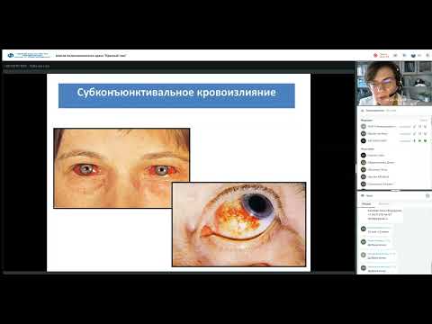 Видео: Школа поликлинического врача 10 03 2022 Красный глаз