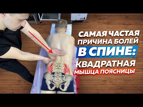 Видео: Квадратная Мышца Поясницы. САМАЯ ЧАСТАЯ причина болей в спине.