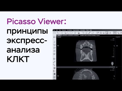 Видео: Принципы экспресс-анализа КЛКТ в Picasso Viewer