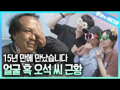 Видео: (Обновление) Осок с гигантской шишкой на лице. Мы встретились с ним снова спустя 15 лет