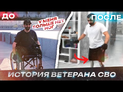 Видео: "Я не хочу привыкать к коляске!" Парная ампутация и бионические протезы.
