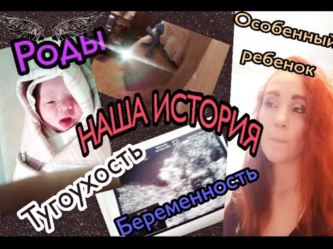 Видео: Наша история/Беременность/Стремительные Роды/Особенный ребенок,Тугоухость,Ребенок инвалид #особенный