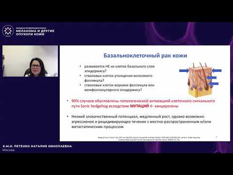 Видео: Базальноклеточный рак и метатипический рак: роль системного лечения