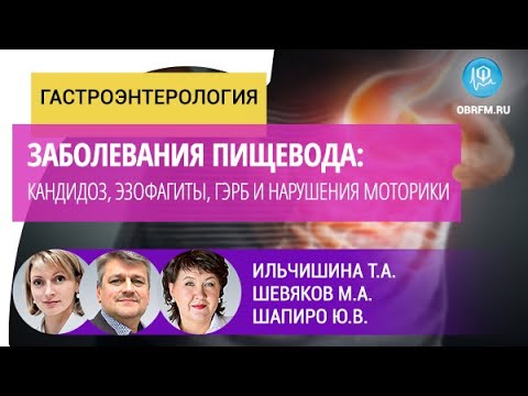 Видео: Гастроэнтеролог Ильчишина Т.А., профессор Шевяков М.А.: Забол-ия пищевода: кандидоз, эзофагиты, ГЭРБ
