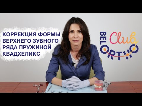 Видео: Коррекция формы верхнего зубного ряда пружиной Квадхеликс | БелОртоКлуб