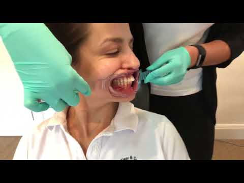 Видео: Демонстрация клинической ортодонтической фотографии от BOSS и доктора Катьяла