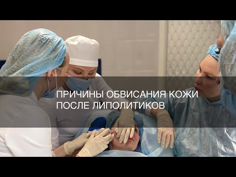 Видео: Причины обвисания кожи после липолитиков и Радиесс