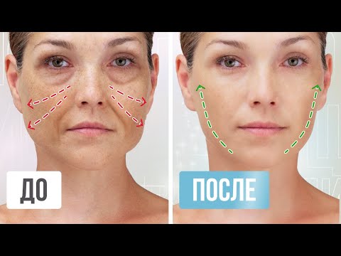 Видео: ЛИФТИНГ МАССАЖ для подтяжки ВСЕГО лица | Эффект омоложения уже после первой процедуры