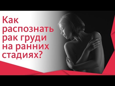 Видео: Рак молочной железы симптомы. 🔬 Симптомы и диагностика рака молочной железы на ранних стадиях. 12+