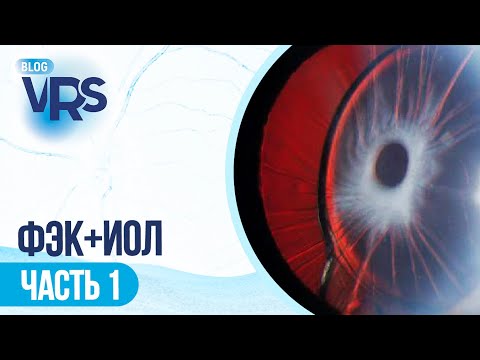 Видео: Хирургия катаракты