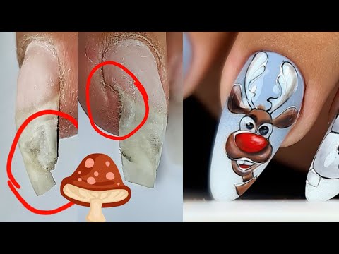 Видео: Маникюр не вовремя. Вот к чему это приводит. Исправляю. Виктория Авдеева