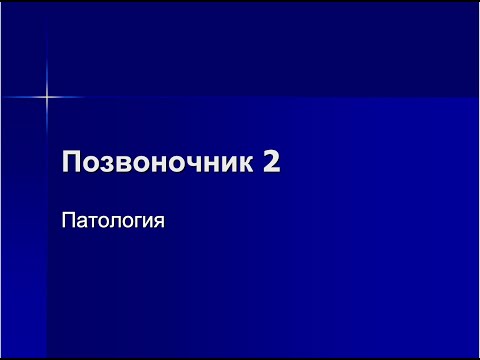 Видео: Кодзаев Ю.К. Позвоночник часть 2 - Патология.