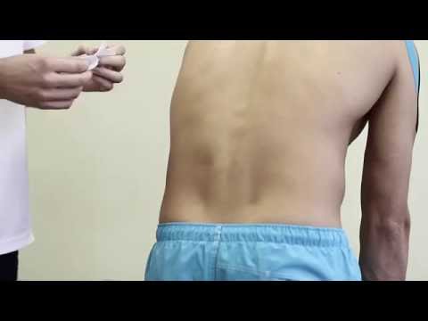 Видео: Кинезиотейпирование при боли в пояснице