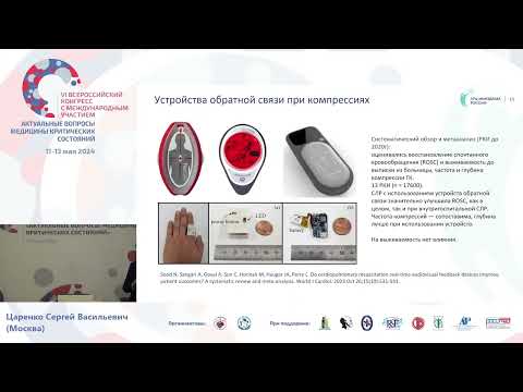 Видео: Перспективы ЭКМО СЛР Царенко С.В.