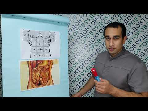 Видео: Как понять, что у вас аппендицит, и что делать  / 99doc