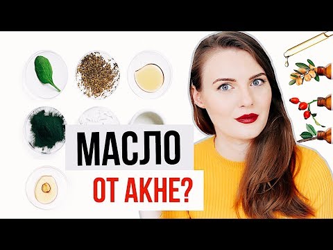 Видео: КАК ИЗБАВИТЬСЯ ОТ ПРЫЩЕЙ? Простой действенный способ!