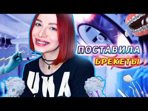 Видео: МНЕ ПОСТАВИЛИ БРЕКЕТЫ // УДАЛИЛА 4 зуба!😱 // КАК я выживаю и терплю боль?! || Цены и первые ощущения