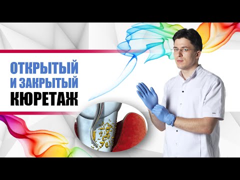 Видео: открытый и закрытый кюретаж