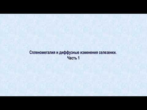 Видео: УЗИ. Доктор Иогансен. Выпуск 61. Спленомегалия и диффузные изменения селезенки. Часть 1.