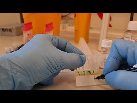 Видео: Непрямая проба Кумбса. Практика. Перезалив в разрешении 4К.