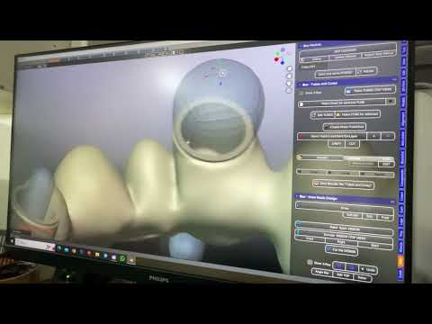 Видео: Blender4dental, B4D, iBAR, Blender, моделировка балки в блендере (часть 1)