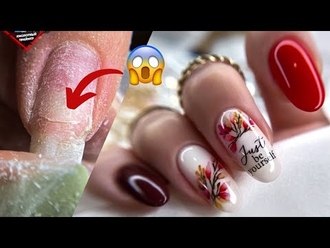 Видео: ЖЕСТКИЕ ТРЕЩИНЫ до МЯСА! ТЕСТИРУЕМ ГЕЛИ с Wildberries ANB!