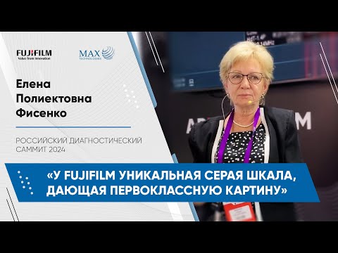 Видео: Методика УЗИ паховых лимфатических узлов Е.П. Фисенко