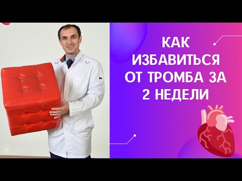 Видео: Как избавиться от тромба за 2 недели. Флеболог. Москва.